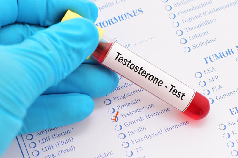 Price of Testosterone Therapy without Insurance Testosterone Test