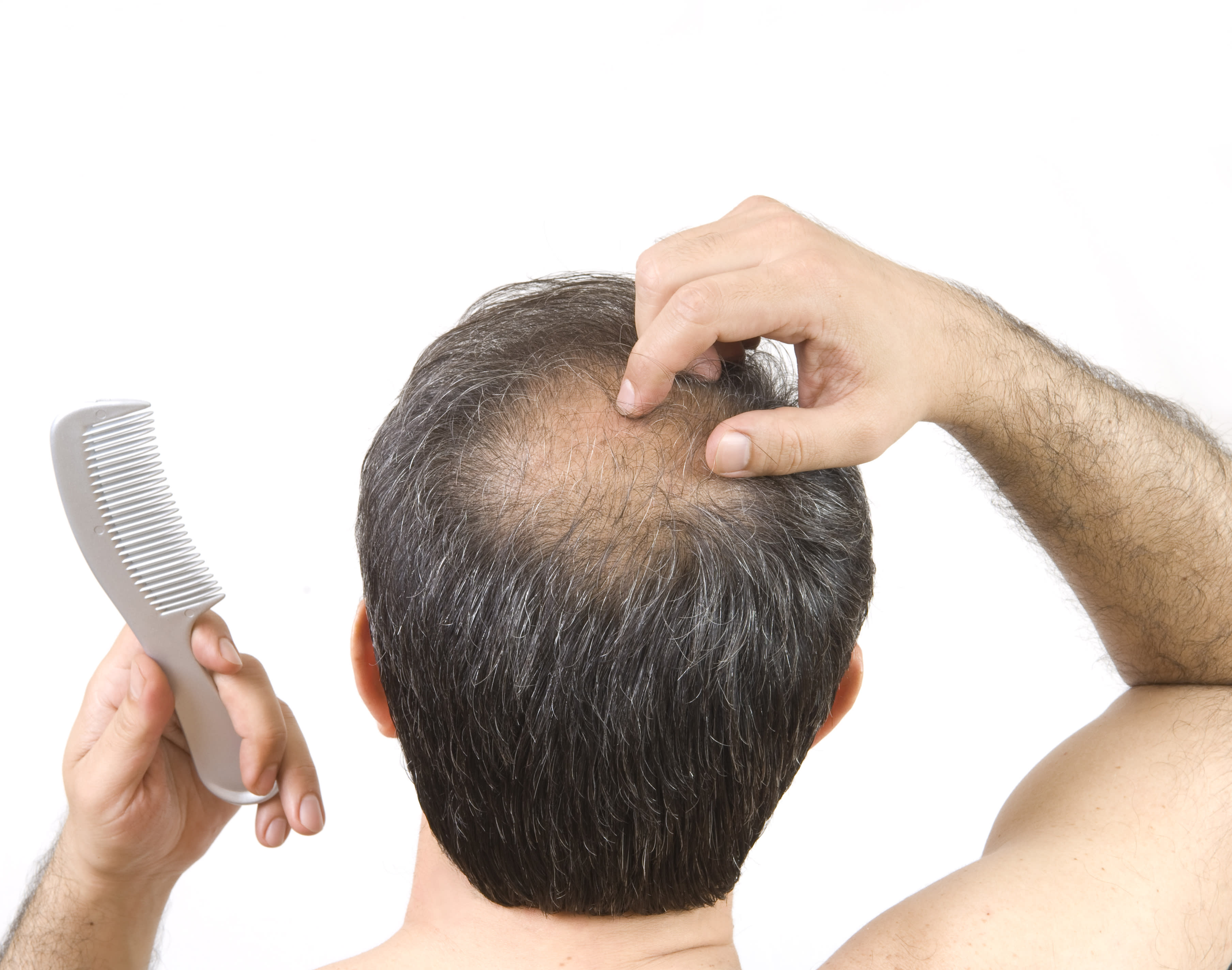 does hgh cause hair loss