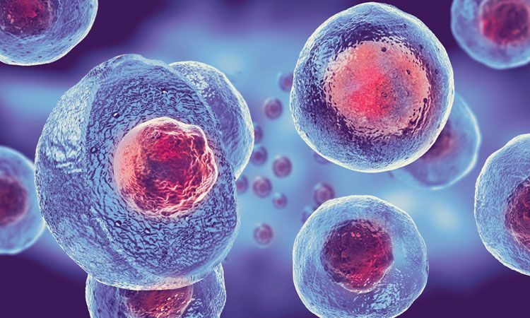 Benefits of Stem Cell Therapy
