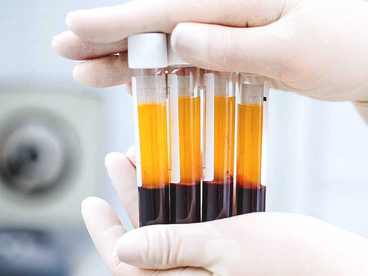 What is Platelet-Rich Plasma Therapy